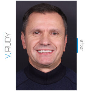vinir26